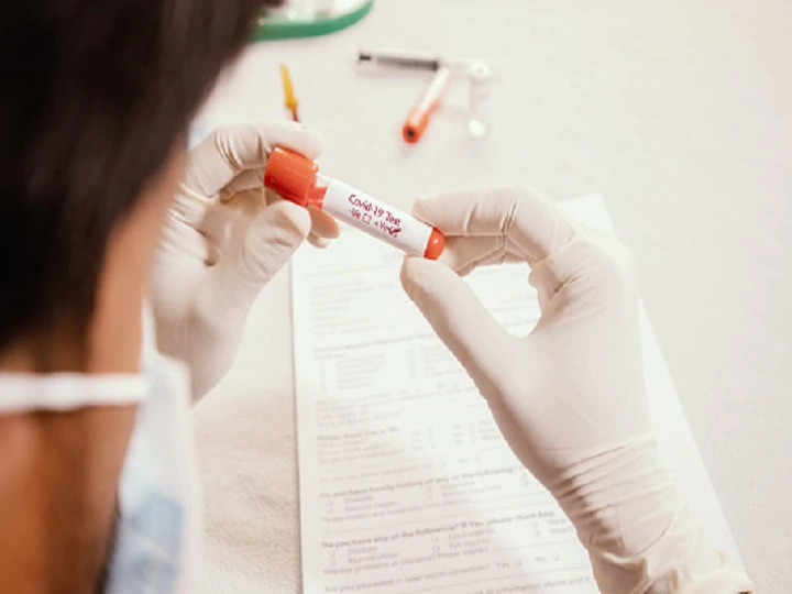 die-us-amerikanische-food-and-drug-agency-genehmigt-kits-fuer-coronavirus-tests-zu-hause